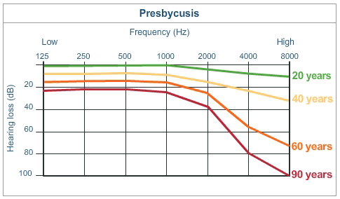 Diagram showing presbycusis - hearing loss due to aging